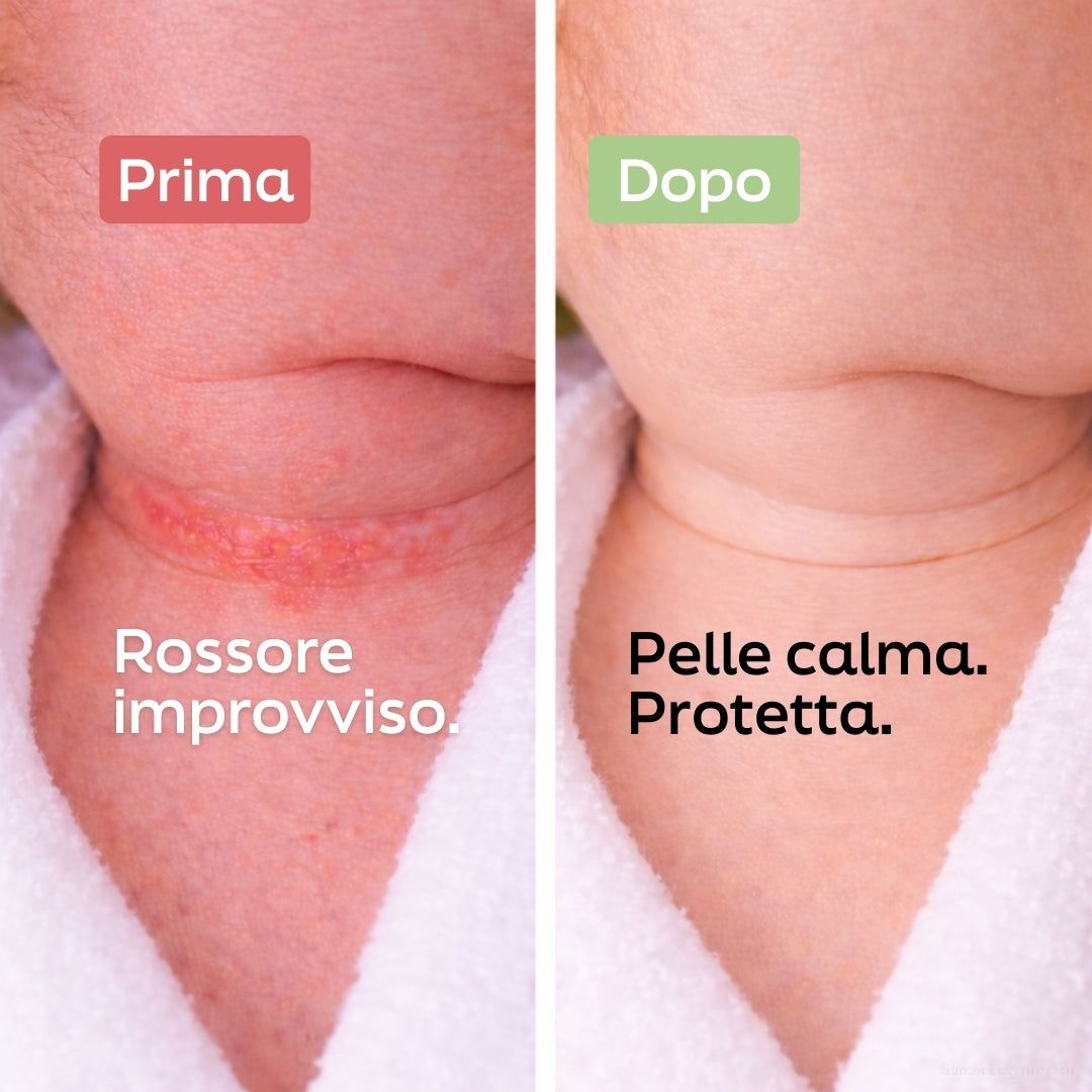 Routine Delicata Anti Rossori